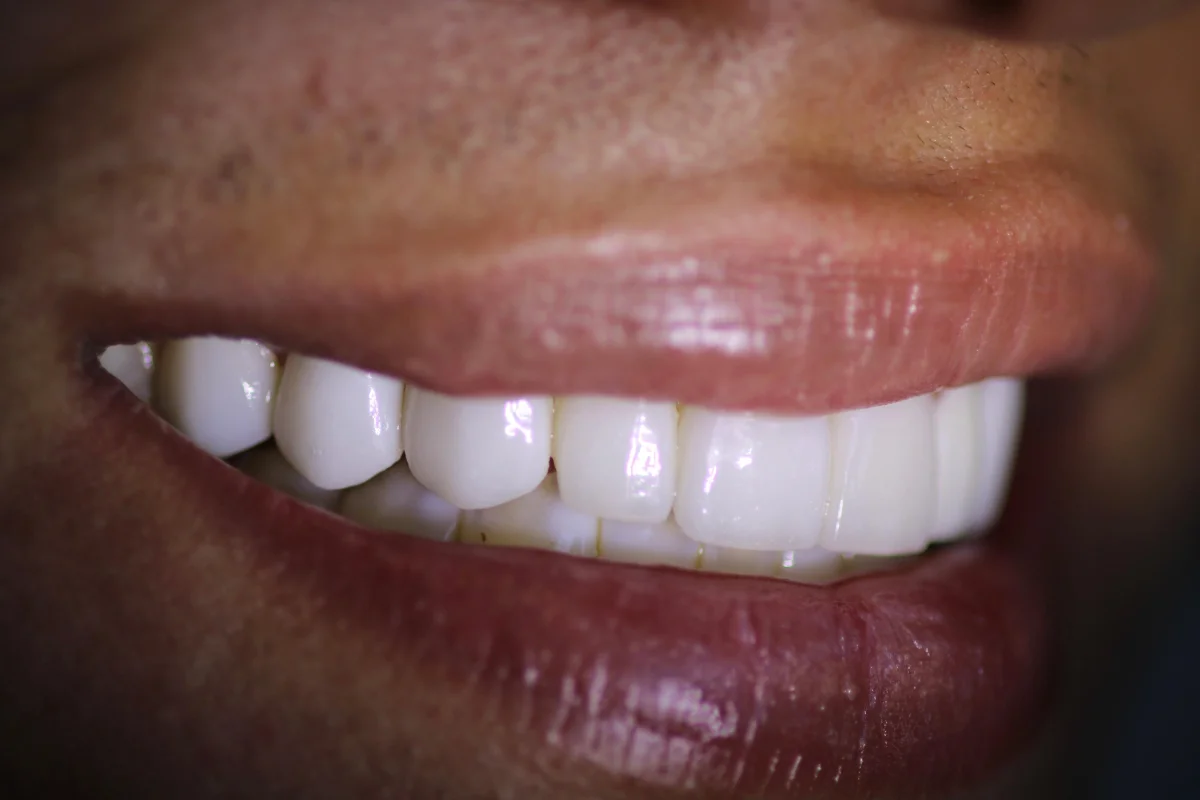 Pacientes felices con su nueva sonrisa (2)