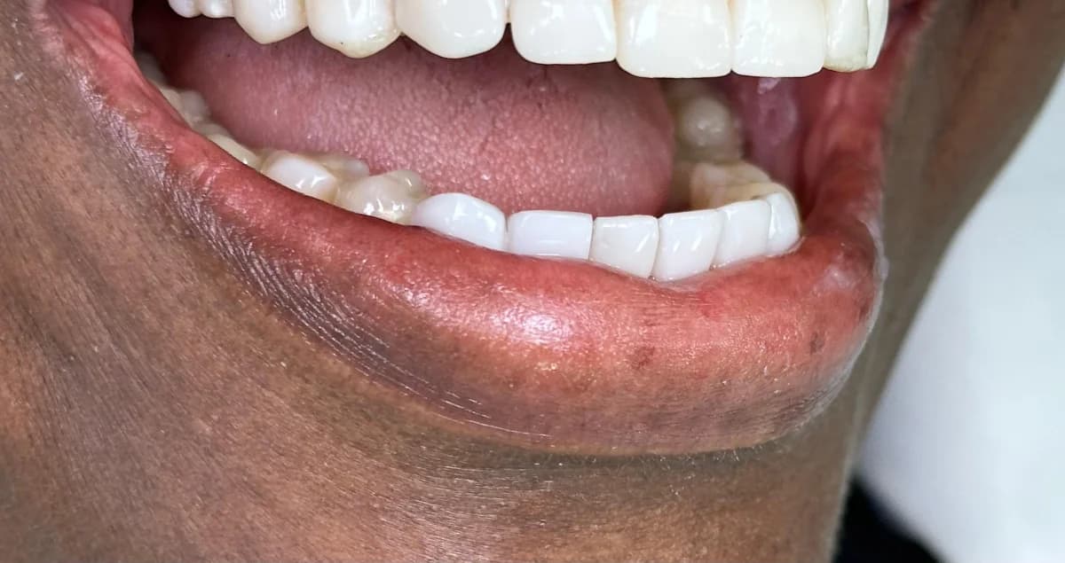 Pacientes felices con su nueva sonrisa (7)