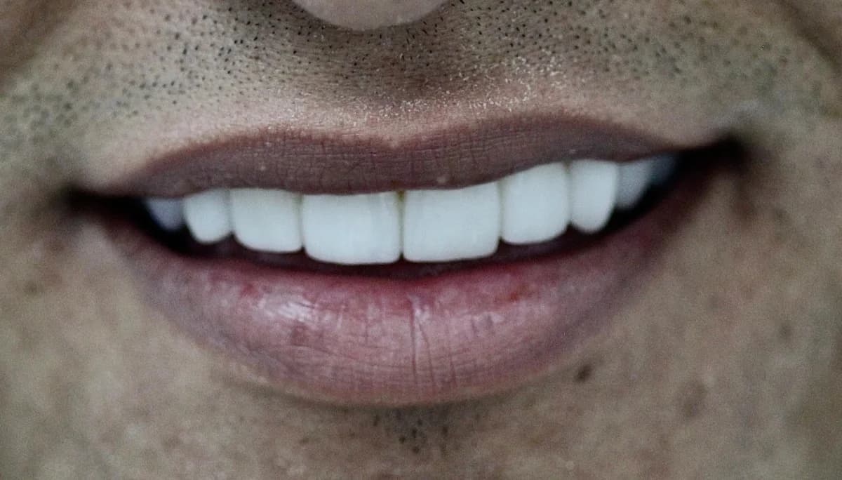 Pacientes felices con su nueva sonrisa (9)