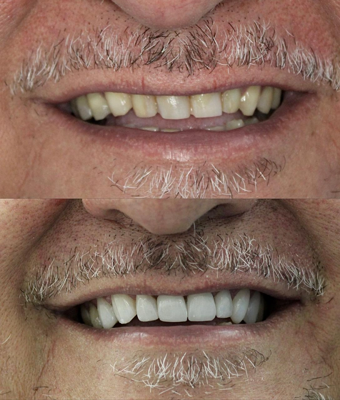 Patient smile transformation 8