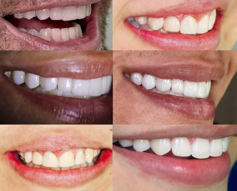 Pacientes felices con su nueva sonrisa